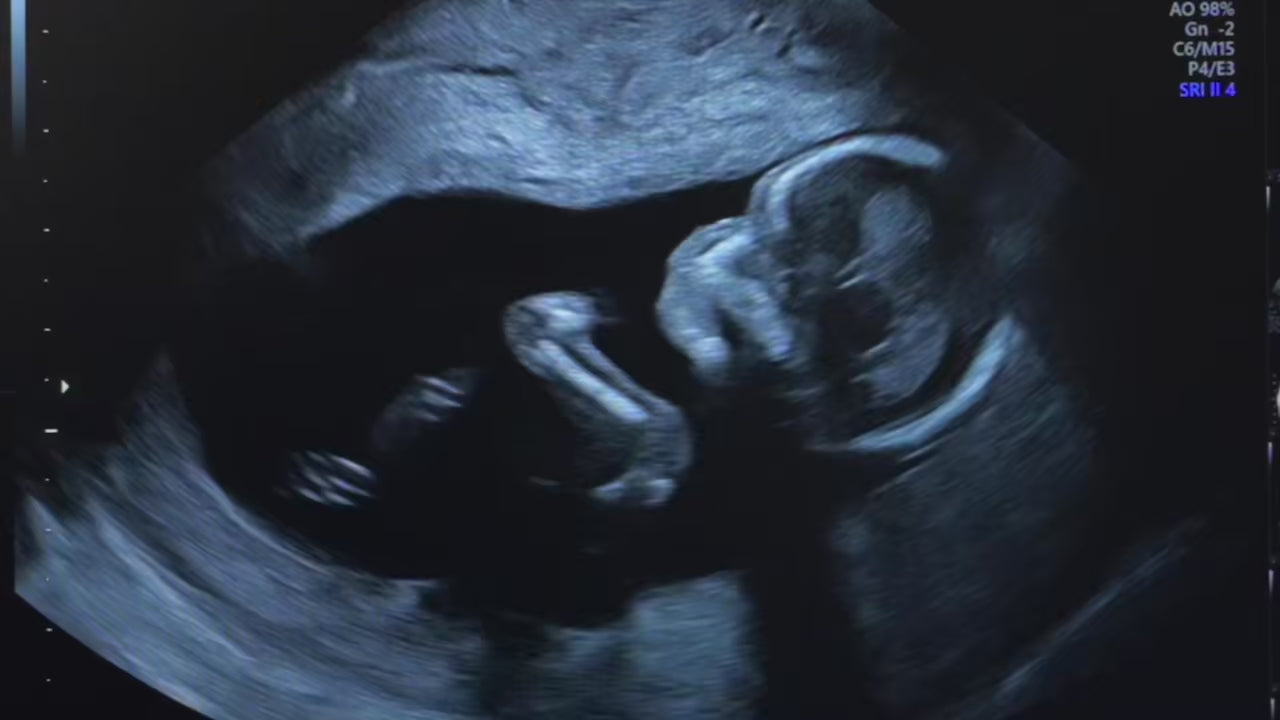 Pañales para bebé | Etapa 2 - Chico  4 a 7 kg